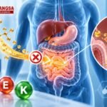 Ilustrasi abetalipoproteinemia sebagai kelainan genetik yang mengganggu penyerapan lemak dan vitamin larut lemak