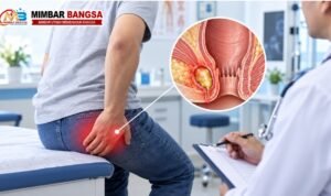 Ilustrasi abses anus, infeksi yang menyebabkan terbentuknya rongga berisi nanah di sekitar anus atau rektum dan umumnya memerlukan evaluasi medis.