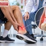 Ilustrasi Achilles tendon rupture atau robekan tendon Achilles di belakang pergelangan kaki