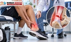 Ilustrasi Achilles tendon rupture atau robekan tendon Achilles di belakang pergelangan kaki