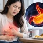 Ilustrasi Asam Lambung Ilustrasi Asam Lambung